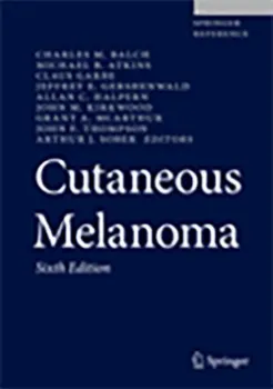 Picture of Book Cutaneous Melanoma