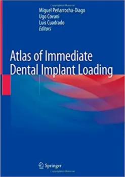 Imagem de Atlas of Immediate Dental Implant Loading