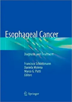 Picture of Book Esophageal Cancer: Diagnosis and Treatment