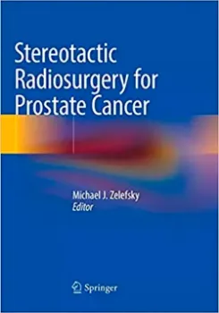 Imagem de Stereotactic Radiosurgery for Prostate Cancer