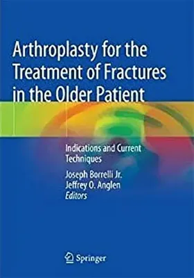 Imagem de Arthroplasty for the Treatment of Fractures in the Older Patient: Indications and Current Techniques