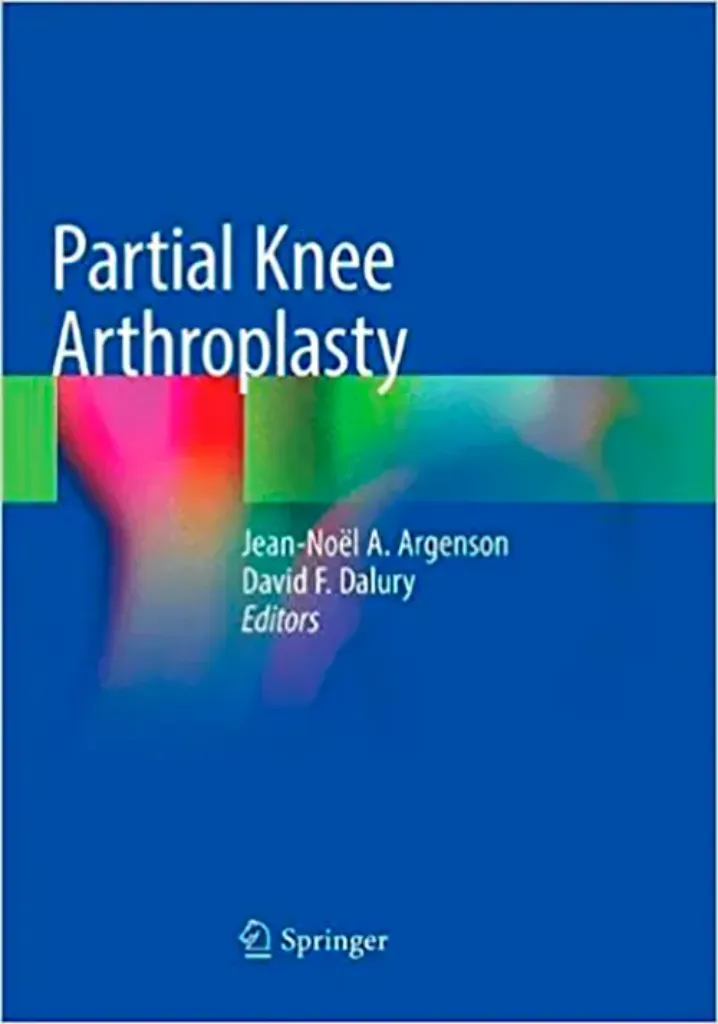 Imagem de Partial Knee Arthroplasty