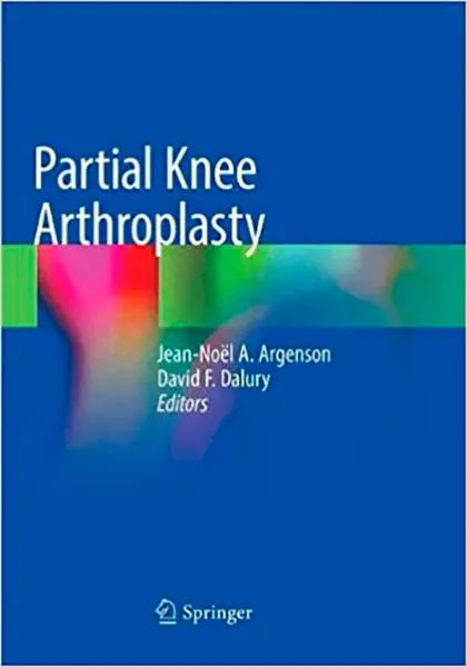 Imagem de Partial Knee Arthroplasty