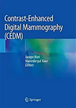 Imagem de Contrast-Enhanced Digital Mammography (CEDM)