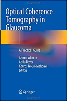 Imagem de Optical Coherence Tomography in Glaucoma: A Practical Guide