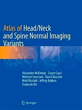 Imagem de Atlas of Head/Neck and Spine Normal Imaging Variants