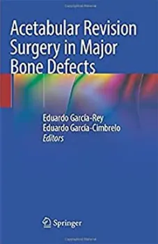 Picture of Book Acetabular Revision Surgery in Major Bone Defects