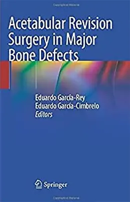 Picture of Book Acetabular Revision Surgery in Major Bone Defects