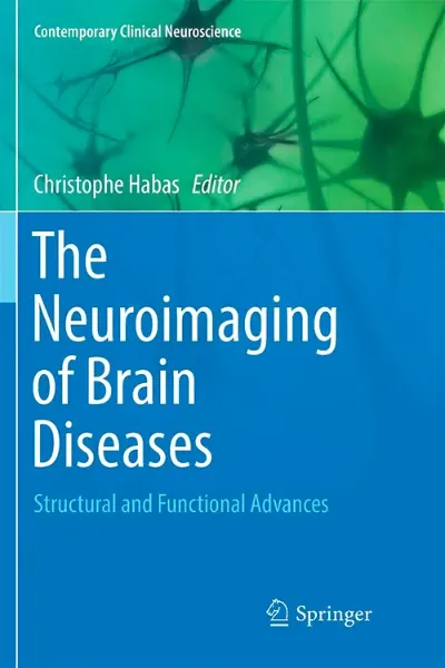 Imagem de The Neuroimaging of Brain Diseases: Structural and Functional Advances