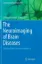 Imagem de The Neuroimaging of Brain Diseases: Structural and Functional Advances
