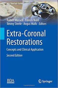 Picture of Book Extra-Coronal Restorations: Concepts and Clinical ApplicationConcepts and Clinical Application