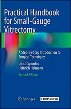Imagem de Practical Handbook for Small-Gauge Vitrectomy: A Step-By-Step Introduction to Surgical Techniques