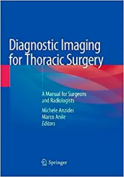 Imagem de Diagnostic Imaging for Thoracic Surgery: A Manual for Surgeons and Radiologists