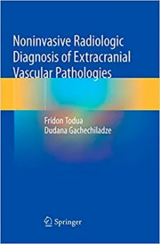 Imagem de Noninvasive Radiologic Diagnosis of Extracranial Vascular Pathologies