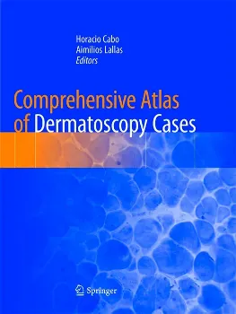 Imagem de Comprehensive Atlas of Dermatoscopy Cases