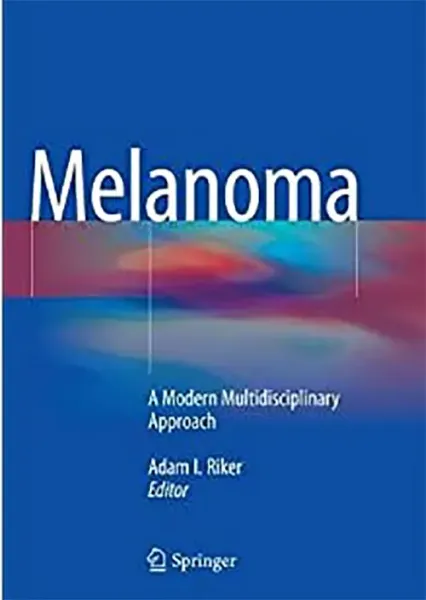 Imagem de Melanoma: A Modern Multidisciplinary Approach