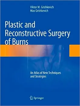 Imagem de Plastic and Reconstructive Surgery of Burns: An Atlas of New Techniques and Strategies
