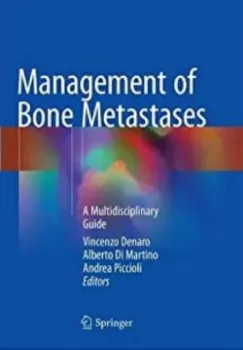 Imagem de Management of Bone Metastases: A Multidisciplinary Guide