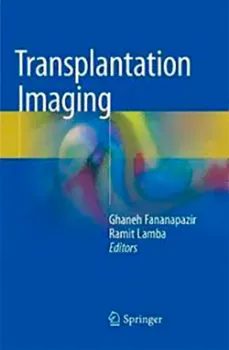 Picture of Book Transplantation Imaging