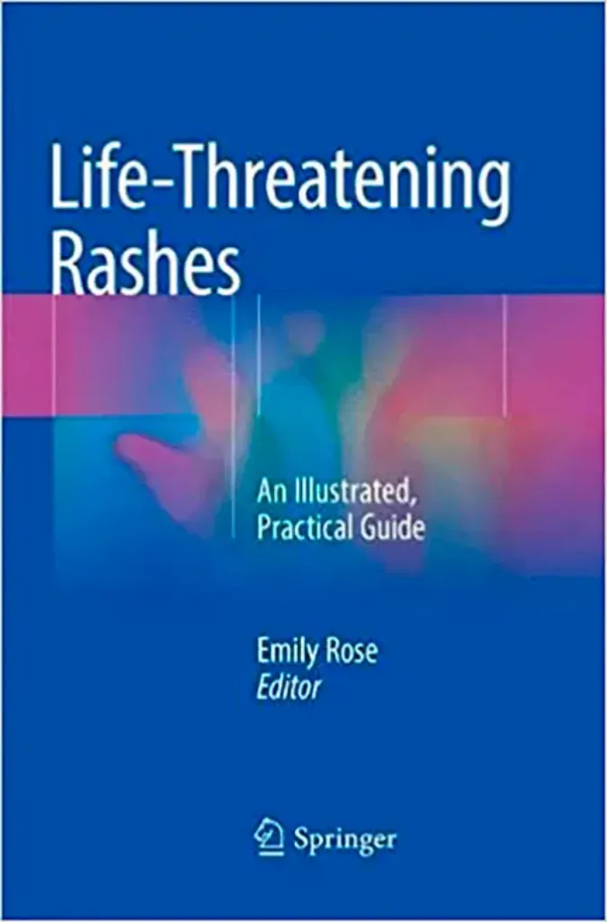 Imagem de Life-Threatening Rashes: An Illustrated, Practical Guide