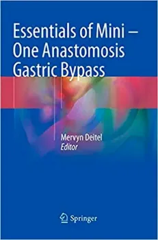 Imagem de Essentials of Mini ‒ One Anastomosis Gastric Bypass