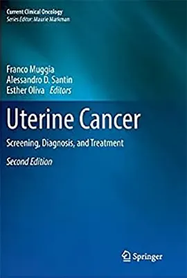 Imagem de Uterine Cancer: Screening, Diagnosis, and Treatment
