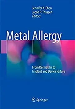 Picture of Book Metal Allergy: From Dermatitis to Implant and Device Failure