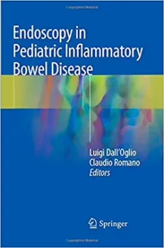 Imagem de Endoscopy in Pediatric Inflammatory Bowel Disease