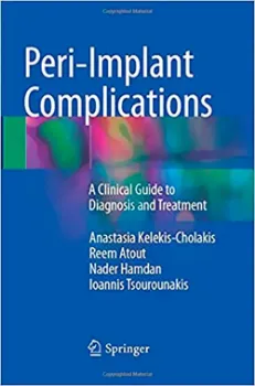Picture of Book Peri-Implant Complications: A Clinical Guide to Diagnosis and Treatment