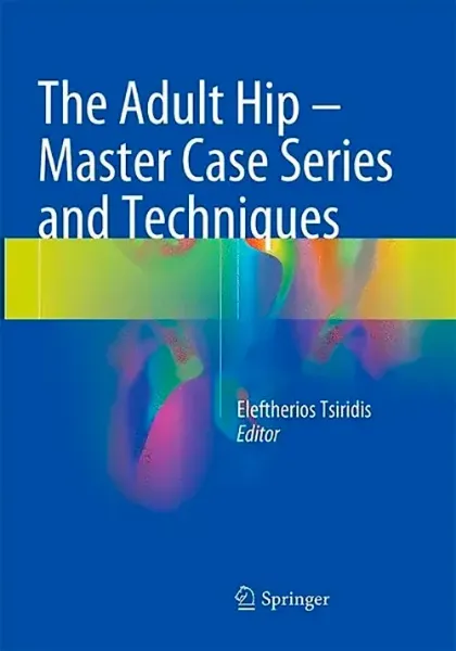 Imagem de The Adult Hip - Master Case Series and Techniques