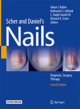 Imagem de Scher and Daniel's Nails: Diagnosis, Surgery, Therapy