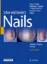 Imagem de Scher and Daniel's Nails: Diagnosis, Surgery, Therapy