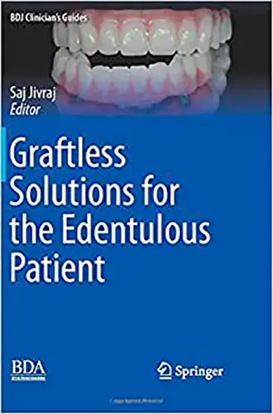 Imagem de Graftless Solutions for the Edentulous Patient