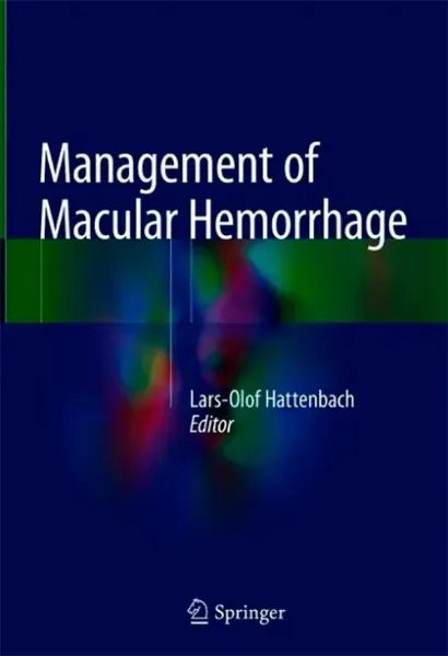 Imagem de Management of Macular Hemorrhage