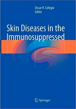 Imagem de Skin Diseases in the Immunosuppressed