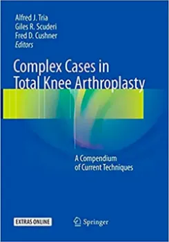 Imagem de Complex Cases in Total Knee Arthroplasty: A Compendium of Current Techniques