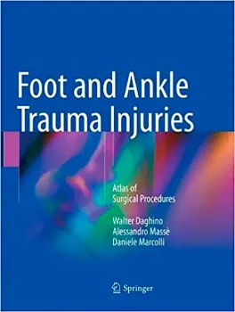 Imagem de Foot and Ankle Trauma Injuries: Atlas of Surgical Procedures