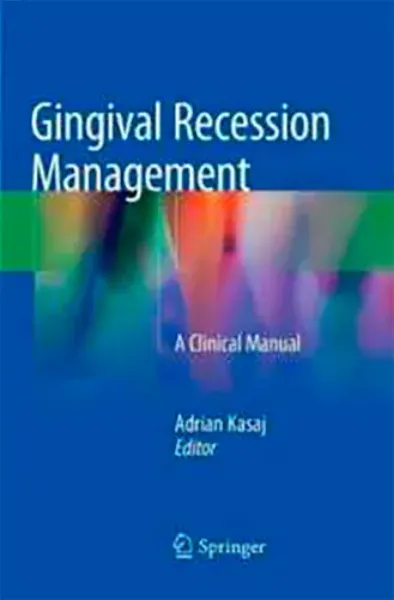 Picture of Book Gingival Recession Management: A Clinical Manual