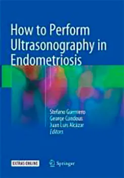 Picture of Book How to Perform Ultrasonography in Endometriosis