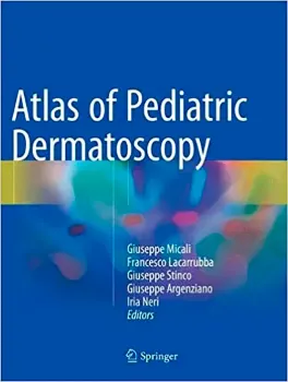 Imagem de Atlas of Pediatric Dermatoscopy