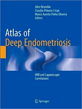 Imagem de Atlas of Deep Endometriosis: MRI and Laparoscopic Correlations
