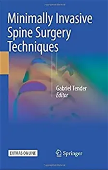Imagem de Minimally Invasive Spine Surgery Techniques