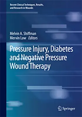 Imagem de Pressure Injury, Diabetes and Negative Pressure Wound Therapy