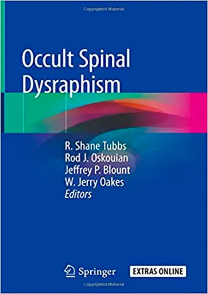 Imagem de Occult Spinal Dysraphism