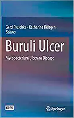 Imagem de Buruli Ulcer: Mycobacterium Ulcerans Disease