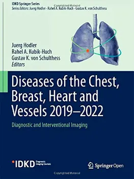Imagem de Diseases of the Chest, Breast, Heart and Vessels 2019-2022: Diagnostic and Interventional Imaging