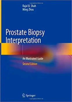 Imagem de Prostate Biopsy Interpretation: An Illustrated Guide