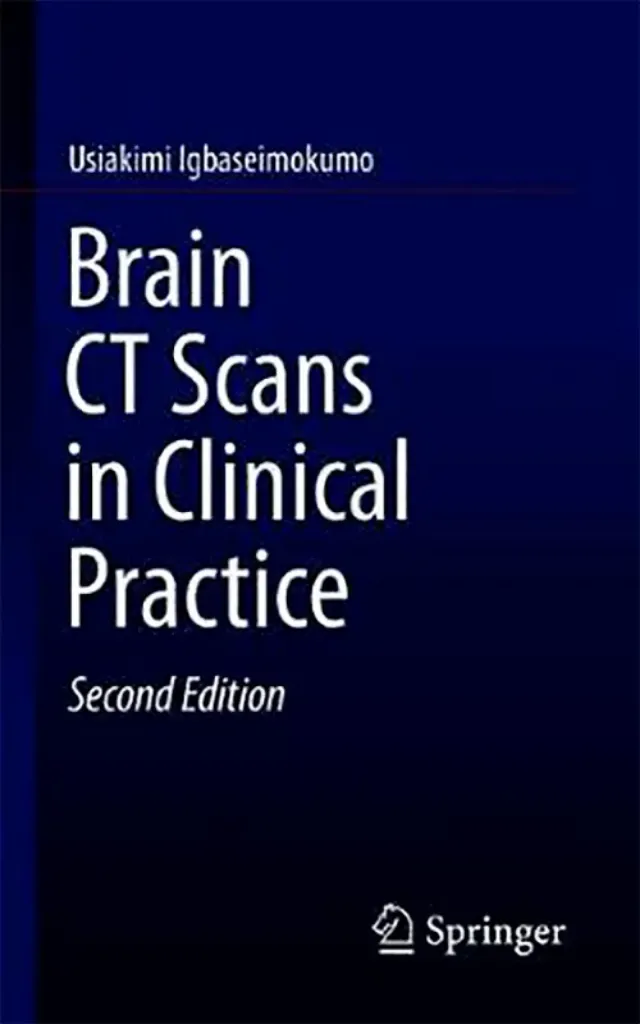 Imagem de Brain CT Scans in Clinical Practice