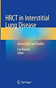 Imagem de HRCT in Interstitial Lung Disease: Instructive Case Studies