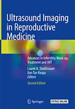 Imagem de Ultrasound Imaging in Reproductive Medicine: Advances in Infertility Work-up, Treatment and ART